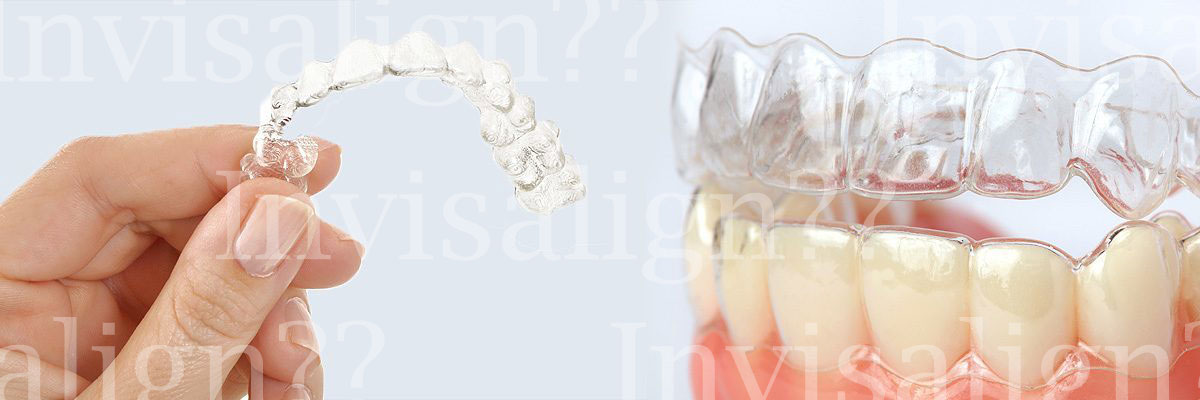 Rockville Does Invisalign® Really Work?