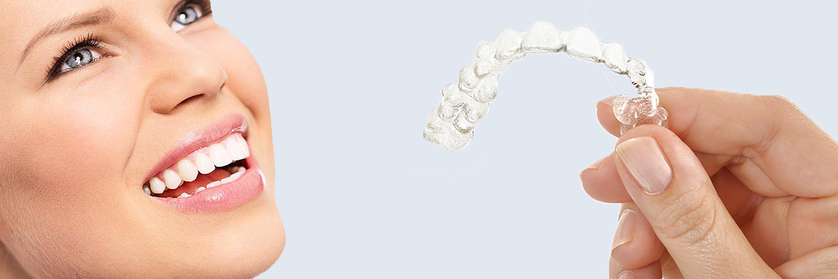 Rockville 7 Things Parents Need to Know About Invisalign Teen